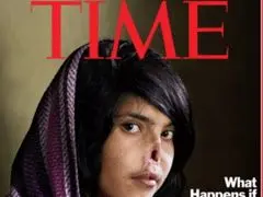 عکس> دختر بینی بریده دوباره به دنیا می‌خندد