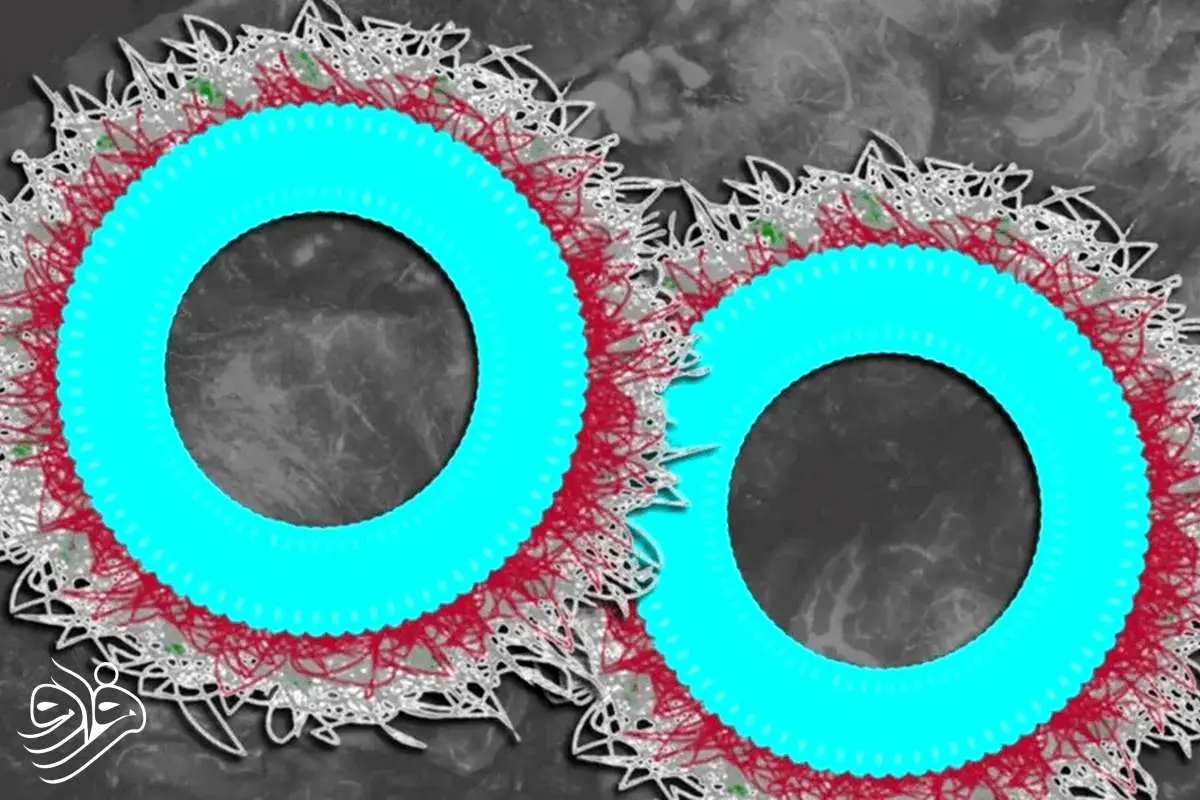 امید تازه برای درمان سرطان تخمدان با فناوری نانو