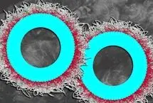 امید تازه برای درمان سرطان تخمدان با فناوری نانو