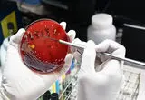 همه آنچه باید درباره طاعون ریوی بدانید
