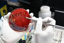 همه آنچه باید درباره طاعون ریوی بدانید