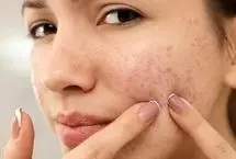 از یک جوش ساده تا یک بیماری مزمن؛ وقتی پوست سیگنال خطر می‌دهد
