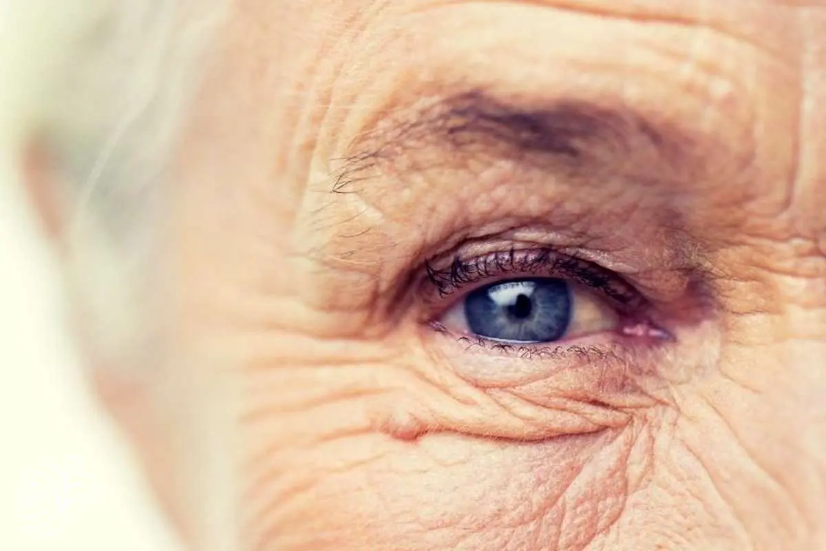 گرمادرمانی؛ امید جدید سالمندان برای جلوگیری از نابینایی