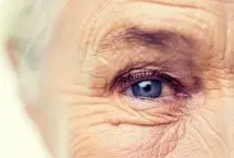 گرمادرمانی؛ امید جدید سالمندان برای جلوگیری از نابینایی