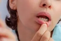 زخم‌های دردناک دهان از کجا می‌آیند؟/ دلایل شایع و راه‌های کاهش درد و پیشگیری