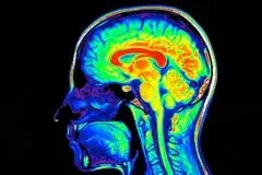 کشف تازه برای پاکسازی مغز