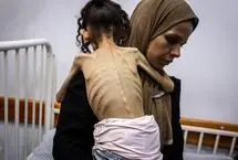 ببینید؛ قحطی در غزه، مریم ۹ ساله دیگر تنها پوست و استخوان است