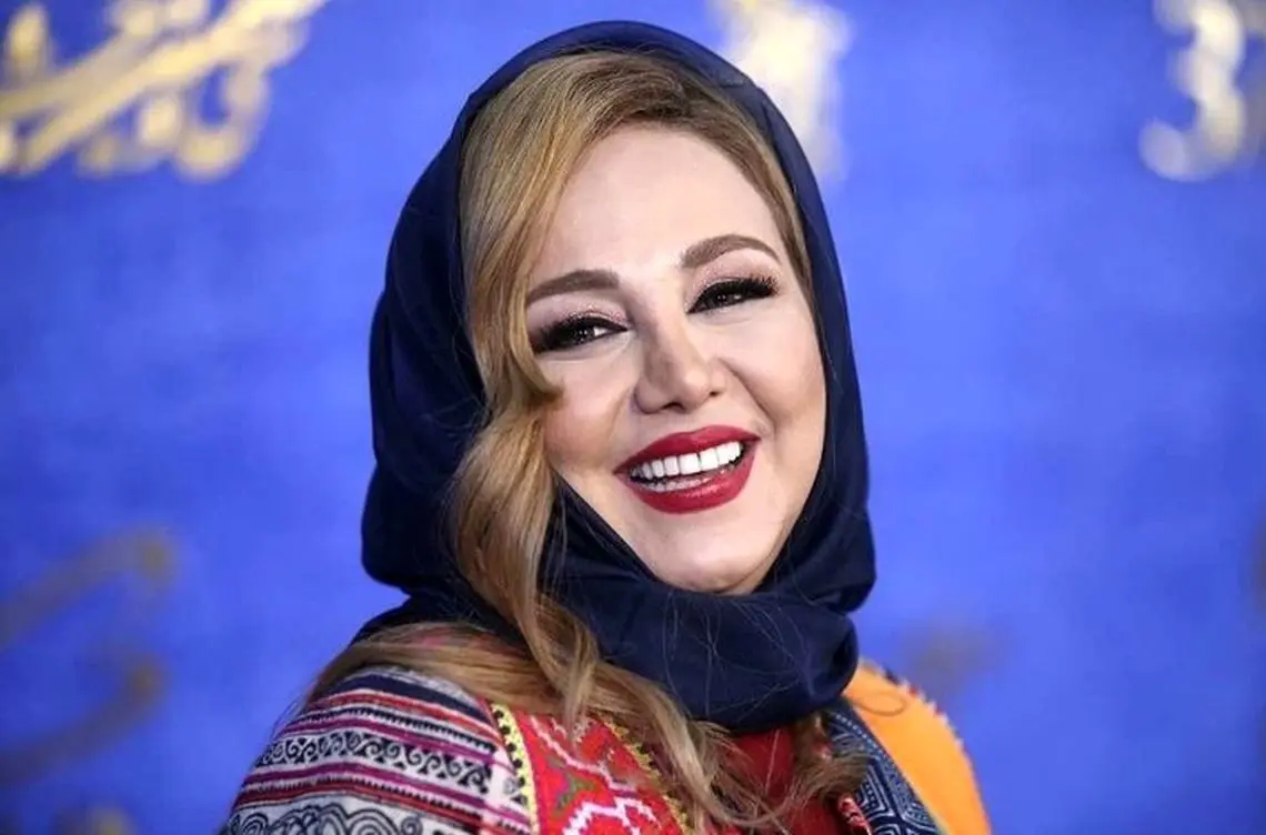 چهره‌ سیاه و سفید بهنوش بختیاری یک استوری