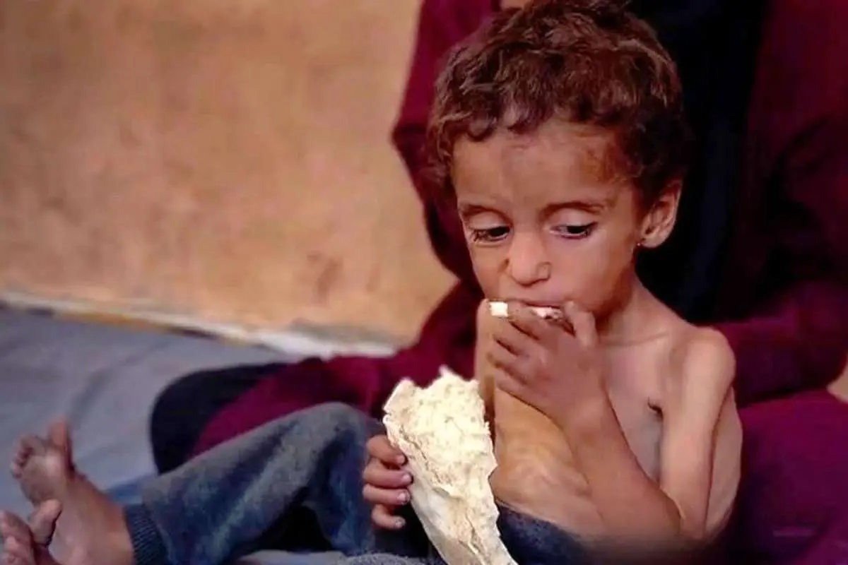 ببینید؛ بحران گرسنگی غزه در یک قاب