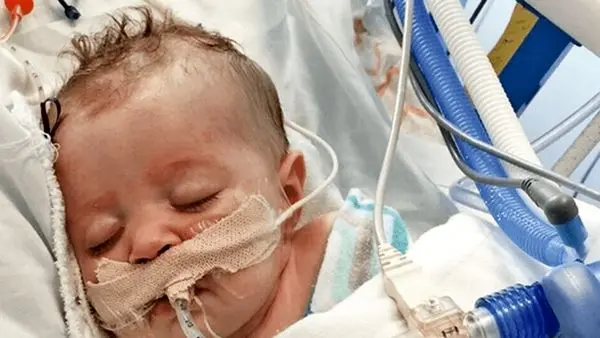 روایت بلاتکلیفی ۳ میلیون بیمار نادر در ایران!