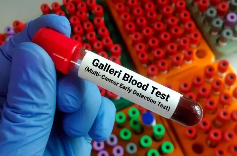 آزمایش خونی که بیش از ۵۰ نوع سرطان را در مراحل اولیه تشخیص می دهد