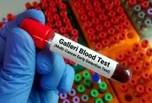 آزمایش خونی که بیش از ۵۰ نوع سرطان را در مراحل اولیه تشخیص می دهد