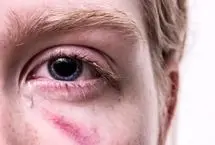 در خاطر داشتن آنچه آزار می‌دهد: خاموش کردن پژواک زخم‌ روحی