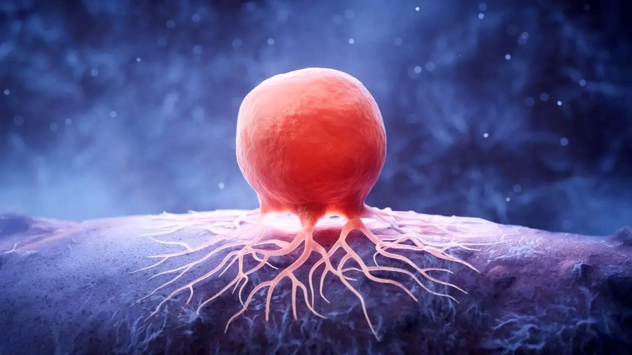 کشف رابطه مستقیم چاقی و سرطان پستان