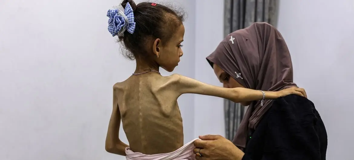 گزارش سخنگوی سازمان ملل از تشدید گرسنگی و سوء تغذیه در غزه