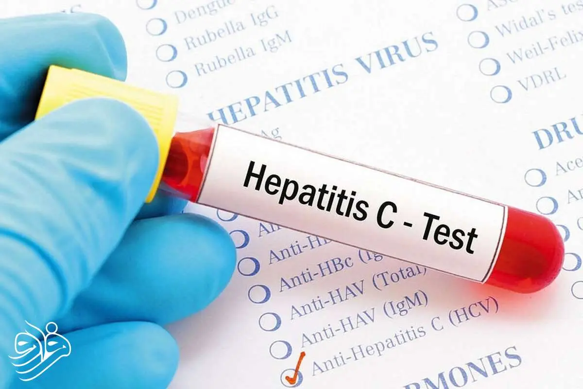 دانشمندان هپاتیت C را در ۱۵ دقیقه تشخیص دادند!