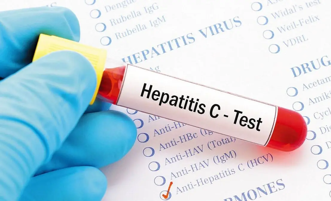 دانشمندان هپاتیت C را در ۱۵ دقیقه تشخیص دادند!