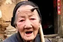 چرا بعضی انسان‌ها «شاخ» درمی‌آورند؟