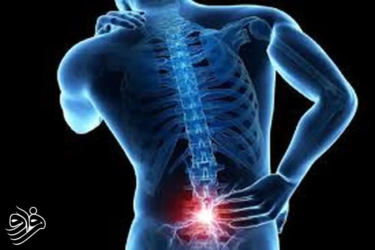 درمان کمردرد بدون جراحی؛ فناوری نوین ترمیم دیسک بین‌مهره‌ای