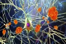 کشف پروتئینی که ممکن است به درمان آلزایمر منجر شود