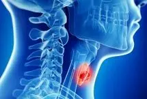 چگونه متوجه شویم تیروئید کم‌کار یا پرکار داریم؟