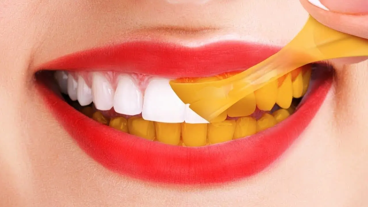 بعد از خوردن چه چیزهایی نیاز نیست مسواک بزنیم؟

