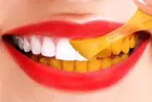 عادت‌هایی که سبب زرد شدن دندان‌ها می‌شود