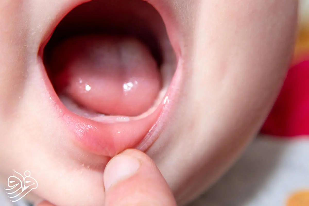 نوزادان مادران پراسترس زودتر دندان درمی‌آورند!