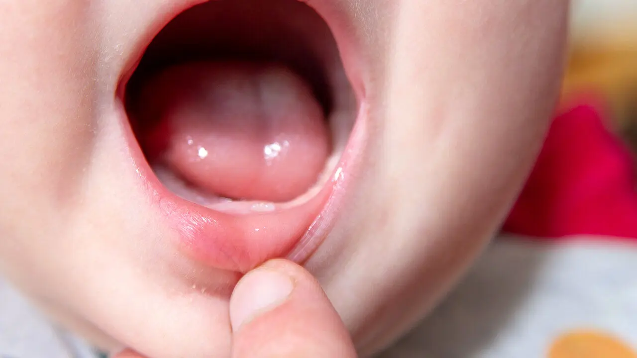 نوزادان مادران پراسترس زودتر دندان درمی‌آورند!