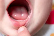 نوزادان مادران پراسترس زودتر دندان درمی‌آورند!