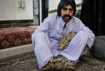 مرد درختی برای درمان راهی آمریکا شد