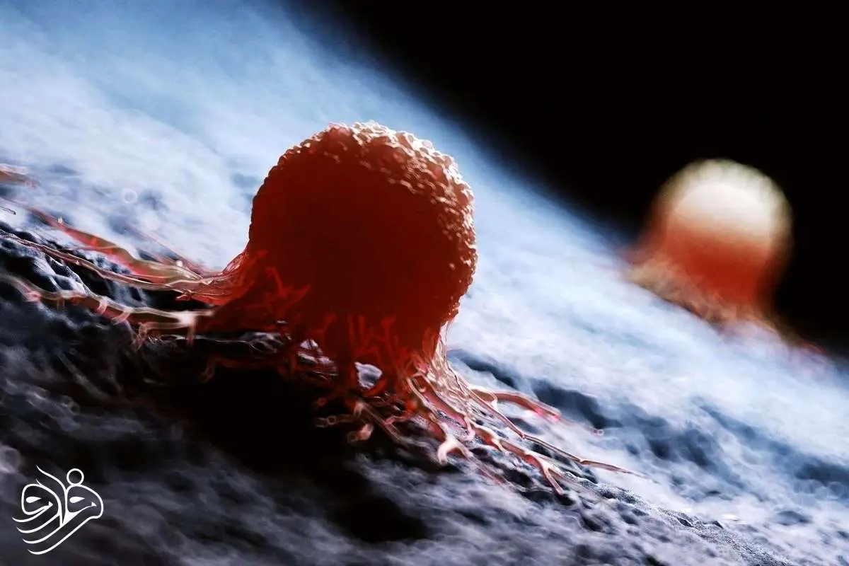 معمای صدساله سرطان توسط هوش مصنوعی حل شد