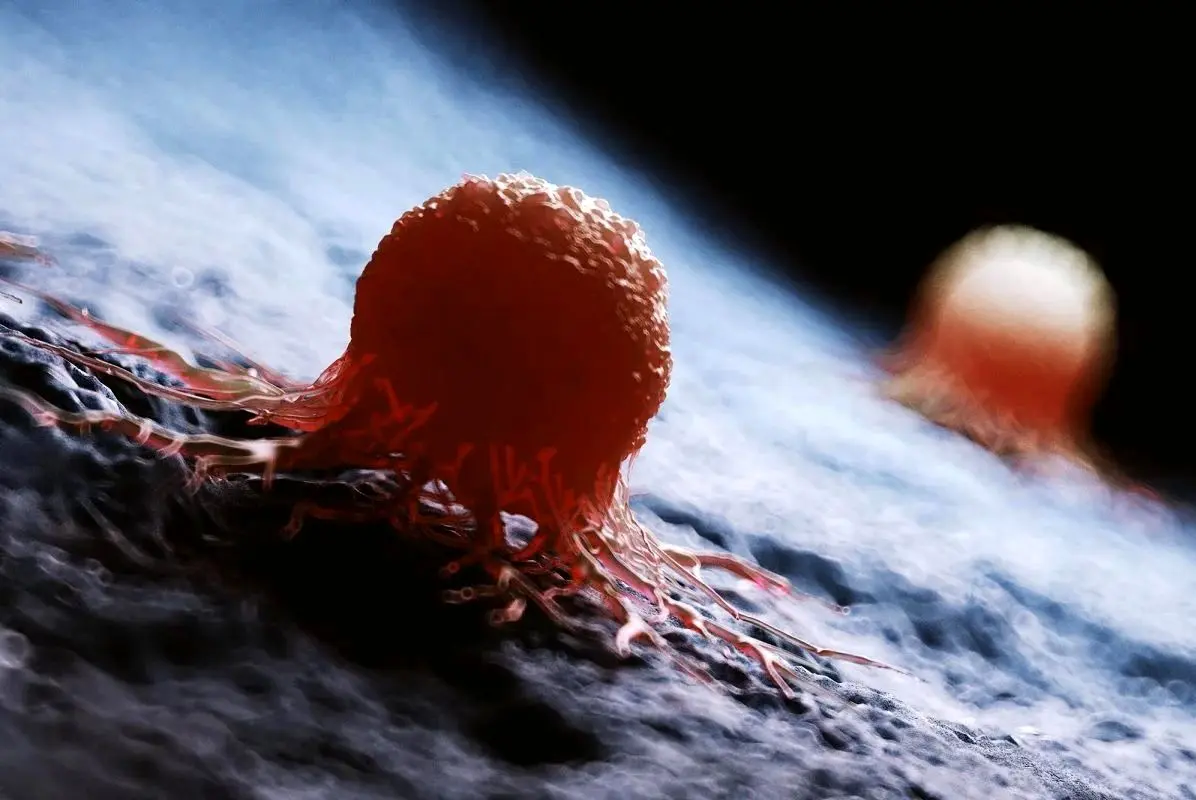 معمای صدساله سرطان توسط هوش مصنوعی حل شد