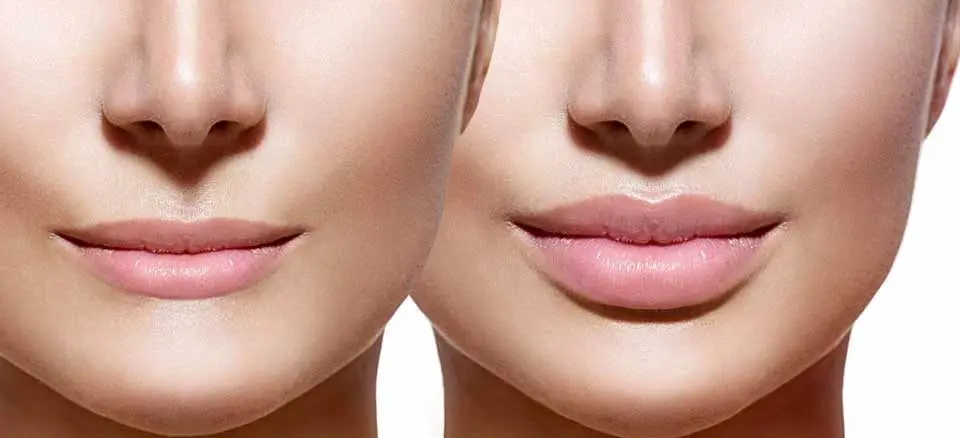 تزریق ژل یا فیلر؟ تفاوت‌ها، کاربردها و انتخاب درست برای شما
