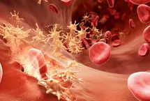 ۱۰ ماده غذایی برای افزایش پلاکت خون