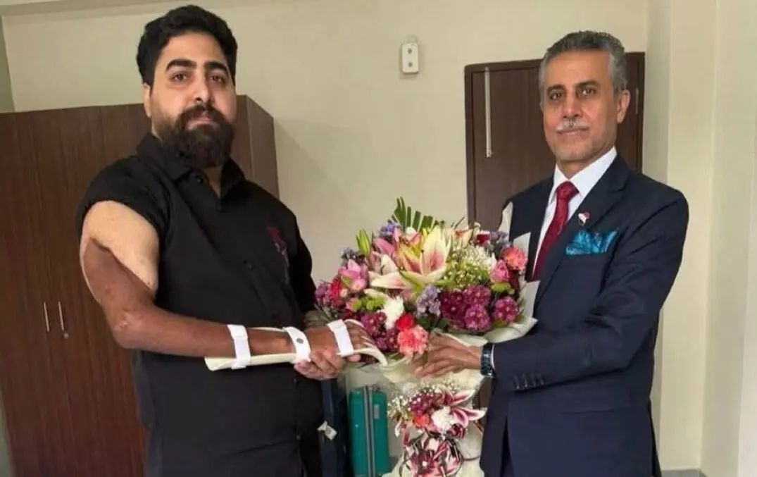 دست یک هندی به بدن نظامی عراقی پیوند زده شد
