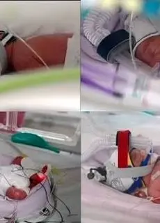 تولد نادر چهارقلوهای کاملاً همسان؛ رخدادی با احتمال یک در ۱۵ میلیون
