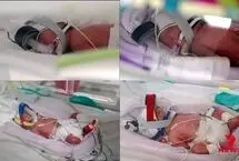 تولد نادر چهارقلوهای کاملاً همسان؛ رخدادی با احتمال یک در ۱۵ میلیون