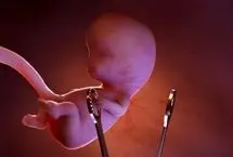 رئیس سازمان بسیج جامعه پزشکی: از ۱۹ هزار سقط عمدی جنین، جلوگیری کردیم
