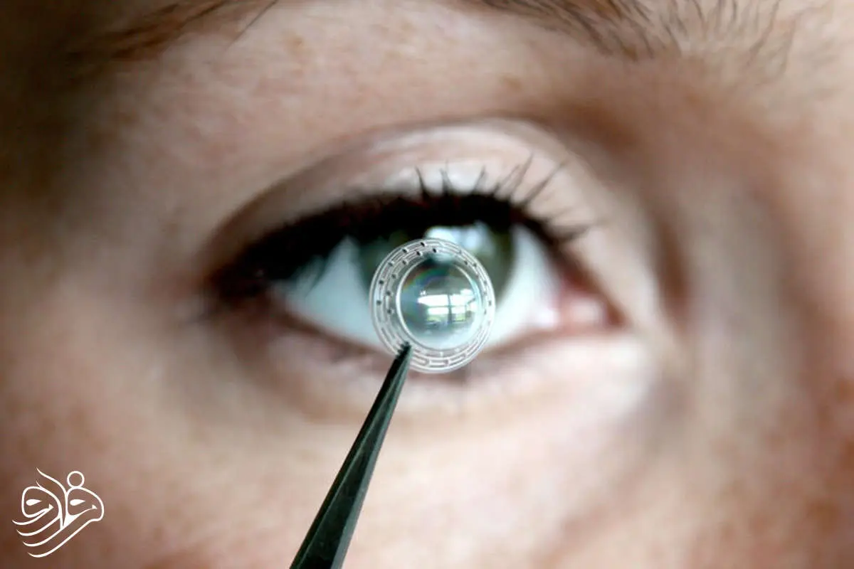 چاپ سه‌بعدی قرنیه نابینایی را درمان کرد
