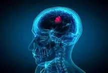 قطره‌ بینی که تومورهای کشنده مغز را کوچک می‌کند