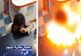  لحظه انفجار باتری لیتیومی در صورت یک نوجوان