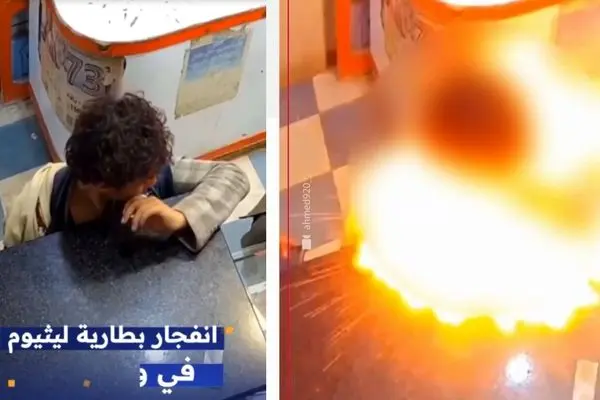  لحظه انفجار باتری لیتیومی در صورت یک نوجوان