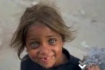 چشم‌های زیبای دختربچه گرسنه فلسطینی 