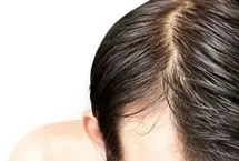 علت چرب شدن سریع موها چیست؟
