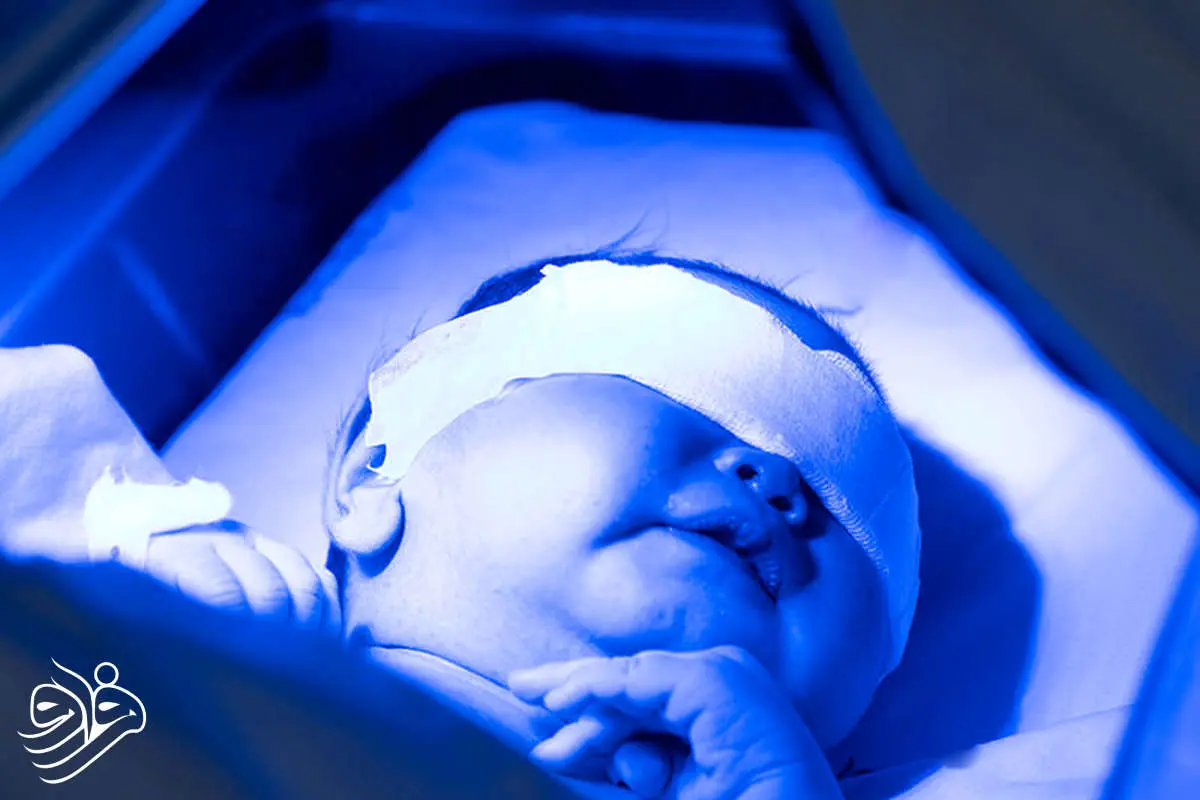 پایش زردی نوزاد با حسگر بزاقی هوشمند، بدون درد و خون‌گیری