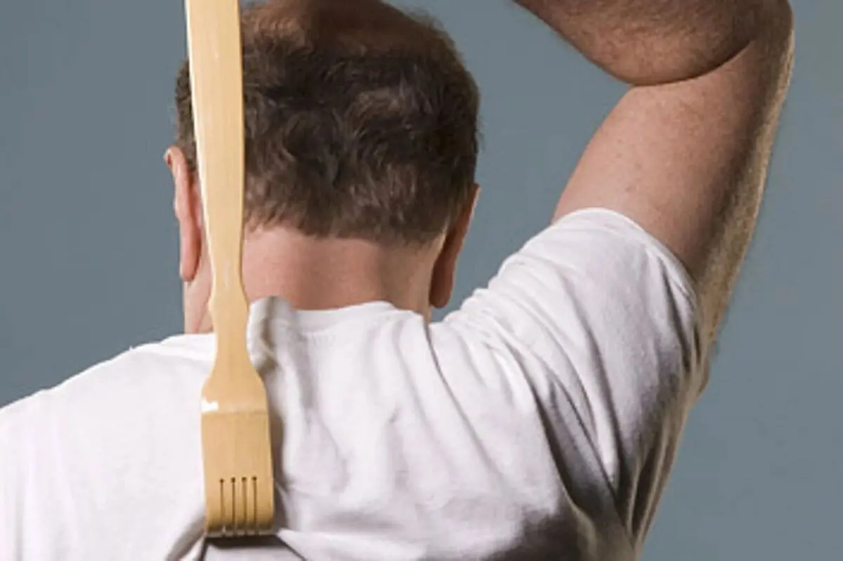 کشف کلید خارش در مغز؛ سامانه‌ای که به ما می‌گوید دست از خاراندن برداریم