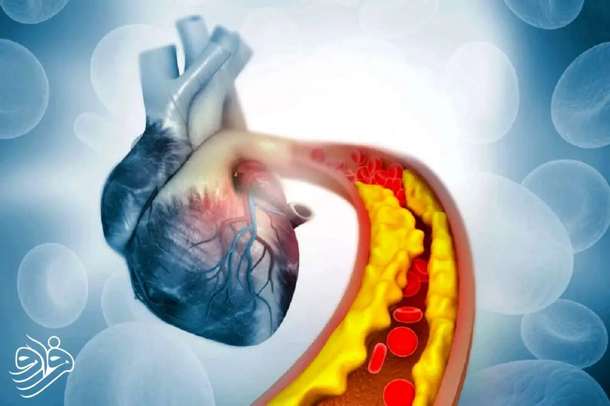پایان قرص های استاتین‌؟ ژن‌درمانی جدید چربی خون را ریشه‌کن می‌کند!