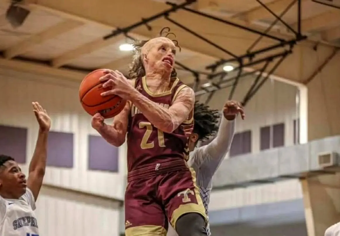 عکس؛ قهرمانی که از میان شعله‌ها برخاست