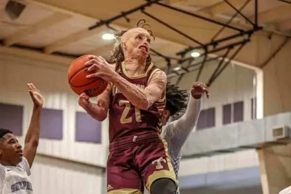 عکس؛ قهرمانی که از میان شعله‌ها برخاست